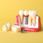 The importance of regular dental checkups
